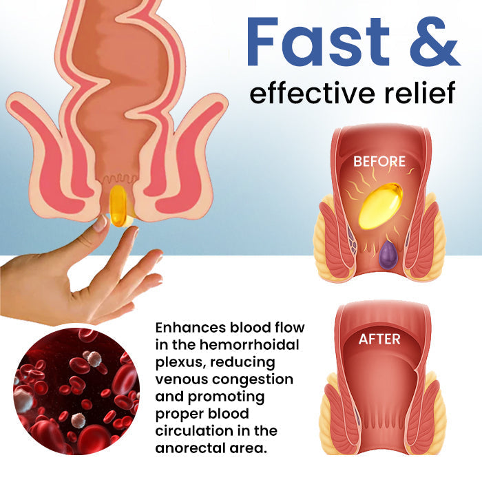 🔥Vânzări fierbinți - 50% OFF🔥Cvreoz® Natural Hemorrhoid CapsulesAcumpărați mai mult Economisiți mai mult