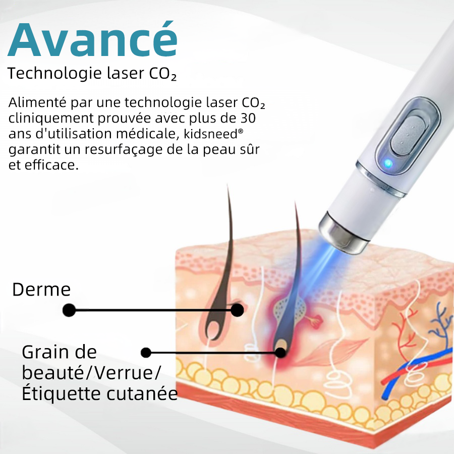 kidsneed® Stilou laser neinvaziv pentru îndepărtarea coșurilor de frumusețe și a negilor ✨✨✨