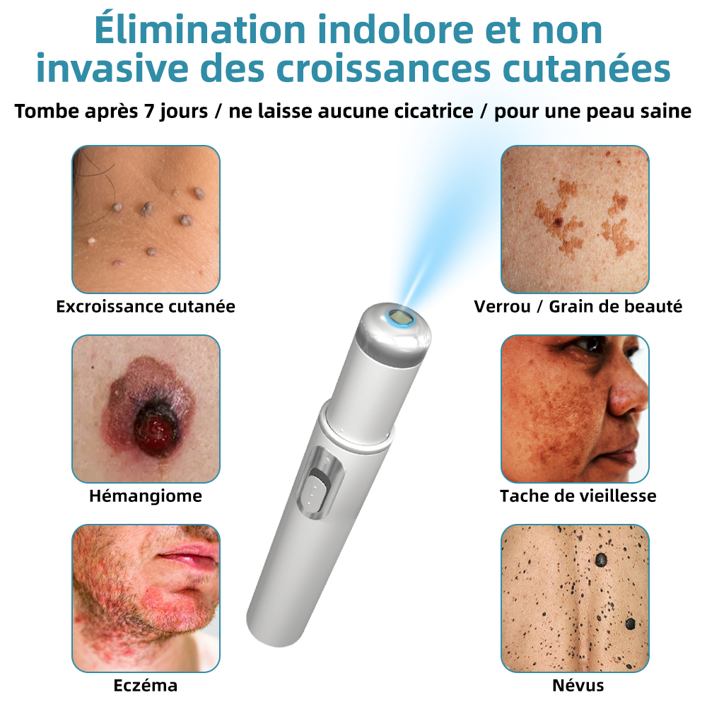 kidsneed® Stilou laser neinvaziv pentru îndepărtarea coșurilor de frumusețe și a negilor ✨✨✨