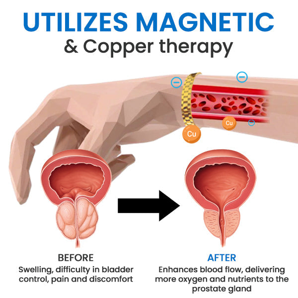 AEXZR™ Bandă magnetică de cupru pentru prostată