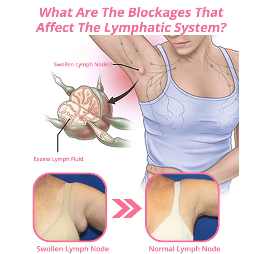 ♥flysmus™ Lymphvity Magnetic Terapie Cercei De Germaniu