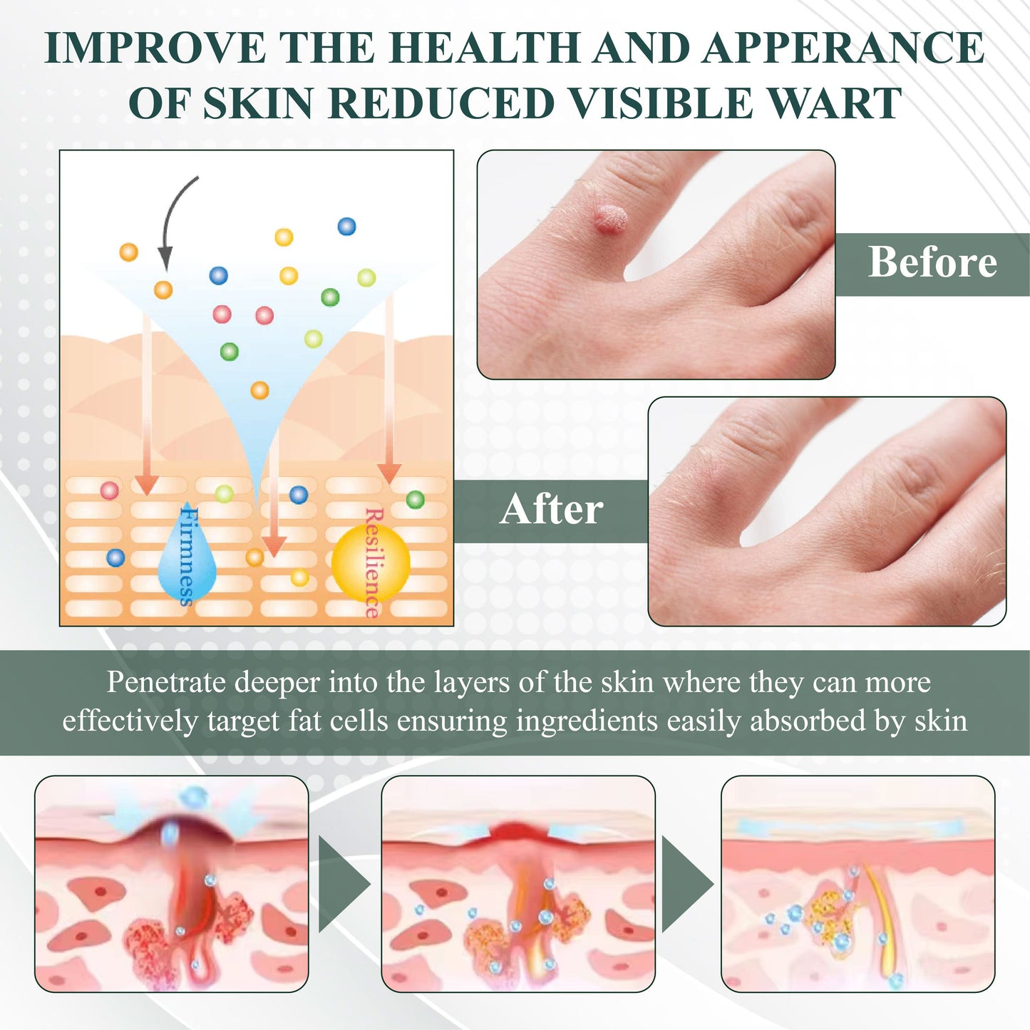 DermaEase™ Natureerase Gel de îndepărtare instantanee a petelor de aluniță