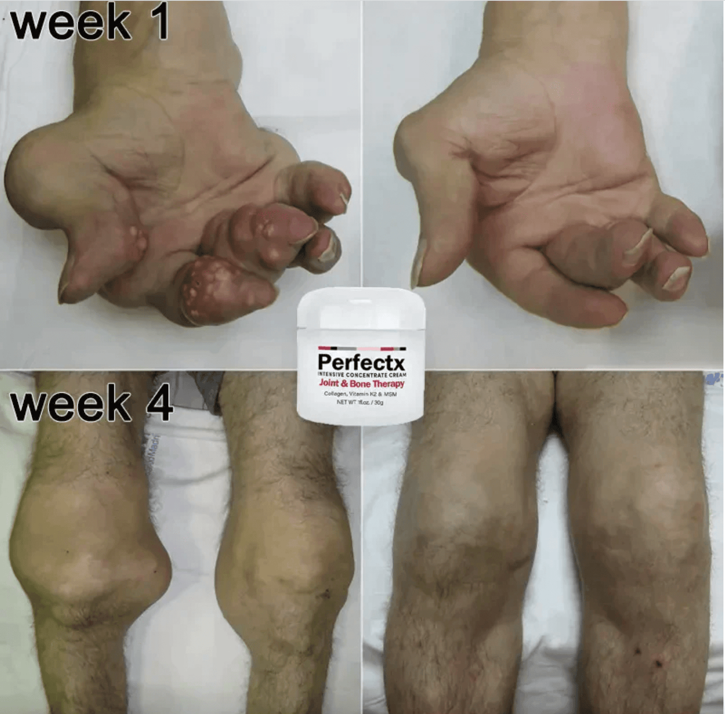 GFOUK™ Perfectx Joint & Bone Therapy Cream KJ 1668