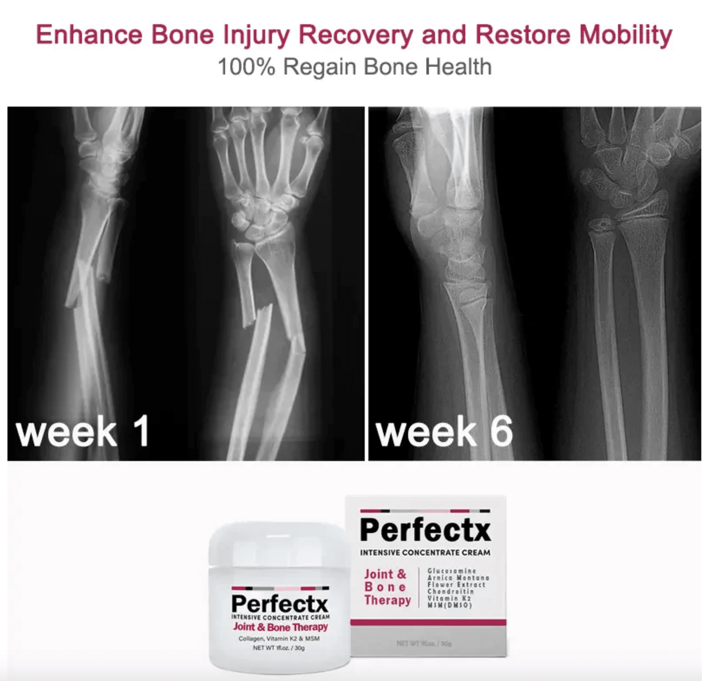 GFOUK™ Perfectx Joint & Bone Therapy Cream KJ 1668