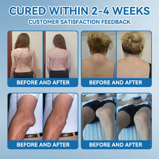 𝖯𝗂𝖼𝗱𝗼® BPC-157 Ízületek regeneráló krém