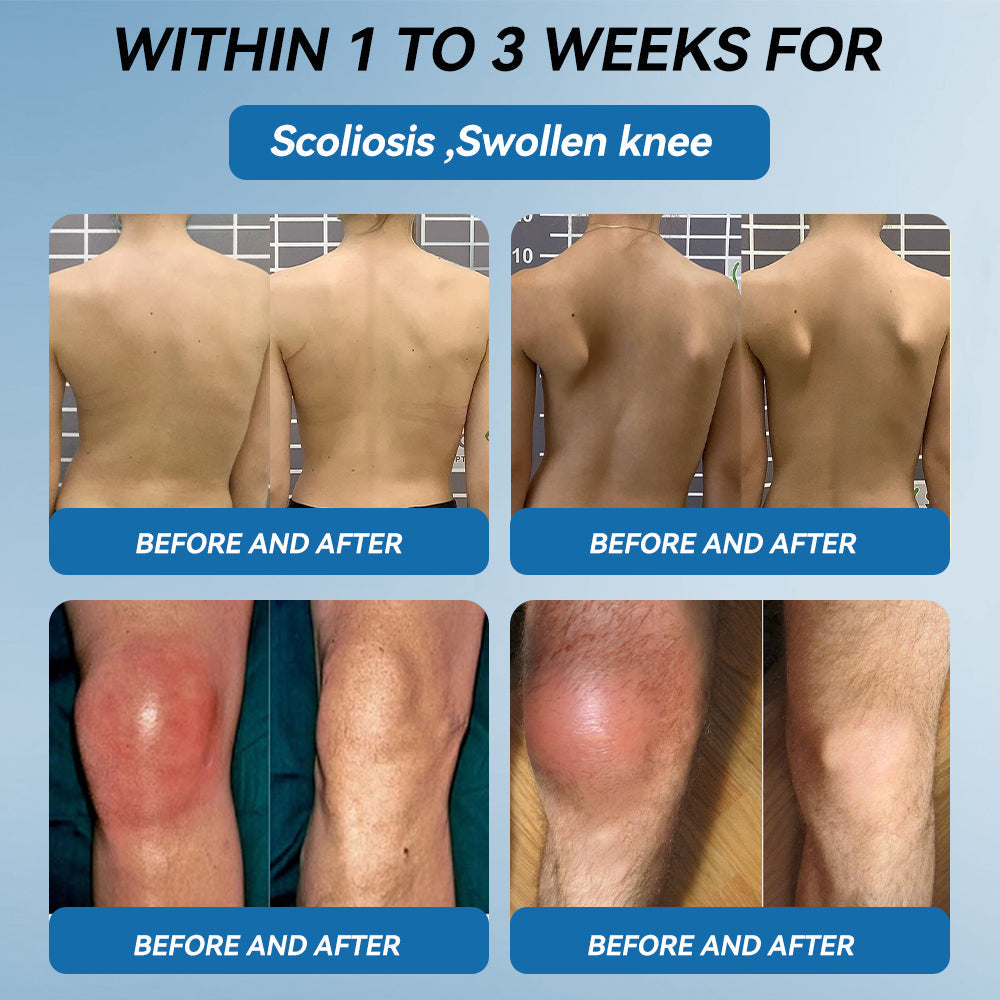 𝖯𝗂𝖼𝗱𝗼® BPC-157 Ízületek regeneráló krém