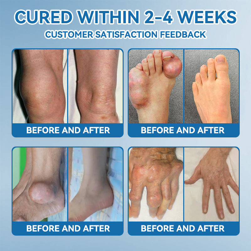 𝖯𝗂𝖼𝗱𝗼® BPC-157 Ízületek regeneráló krém