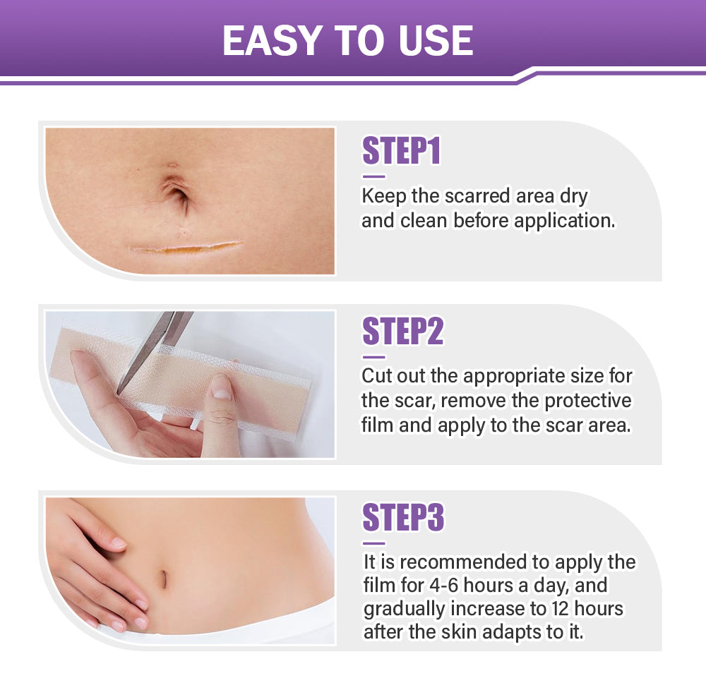 Totai Skin Confidence Începe Aici ✅ Bostore® Acid Hialuronic Nano Microneedle Repair Tape ✴️ Pentru diverse cicatrici, vergeturi, pete, keloide, keratoze, acnee, arsuri, negi, etichete de piele și vene varicoase.