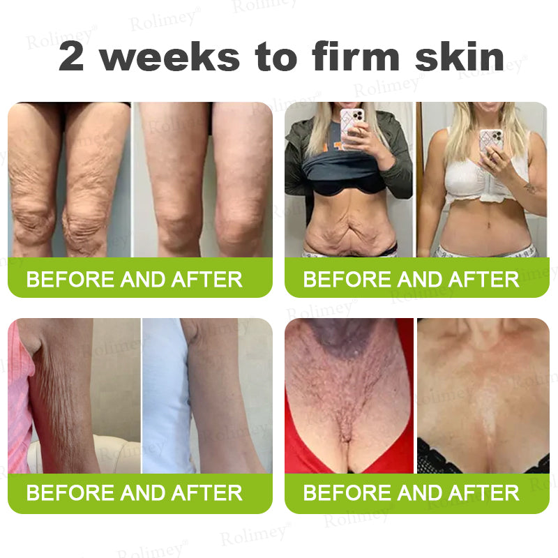 💛✅Az USA-ban gyártva és onnan szállítva 💫Rolimey® Botox & Vita-A Retinol Shot ránctalanító és feszesítő krém – Utolsó napos akció 70% kedvezmény