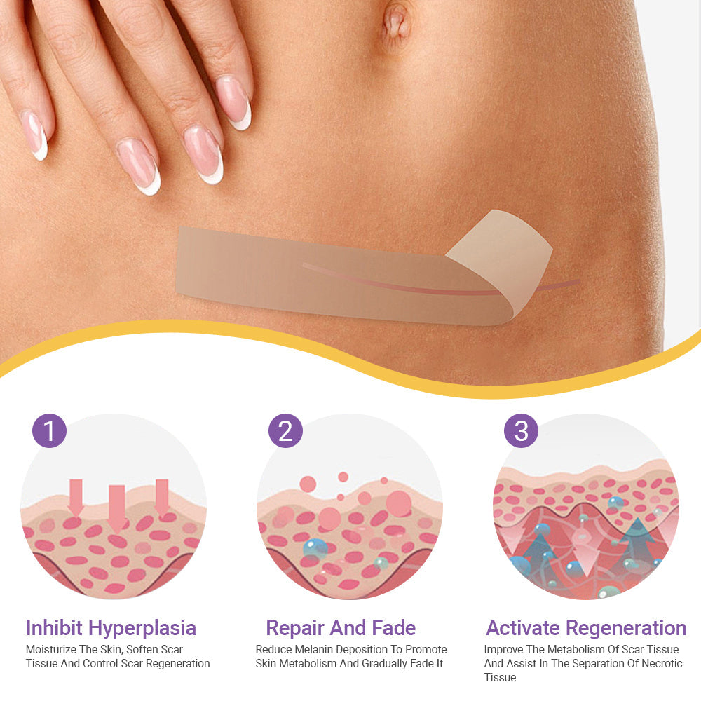 Totai Skin Confidence Începe Aici ✅ Bostore® Acid Hialuronic Nano Microneedle Repair Tape ✴️ Pentru diverse cicatrici, vergeturi, pete, keloide, keratoze, acnee, arsuri, negi, etichete de piele și vene varicoase.