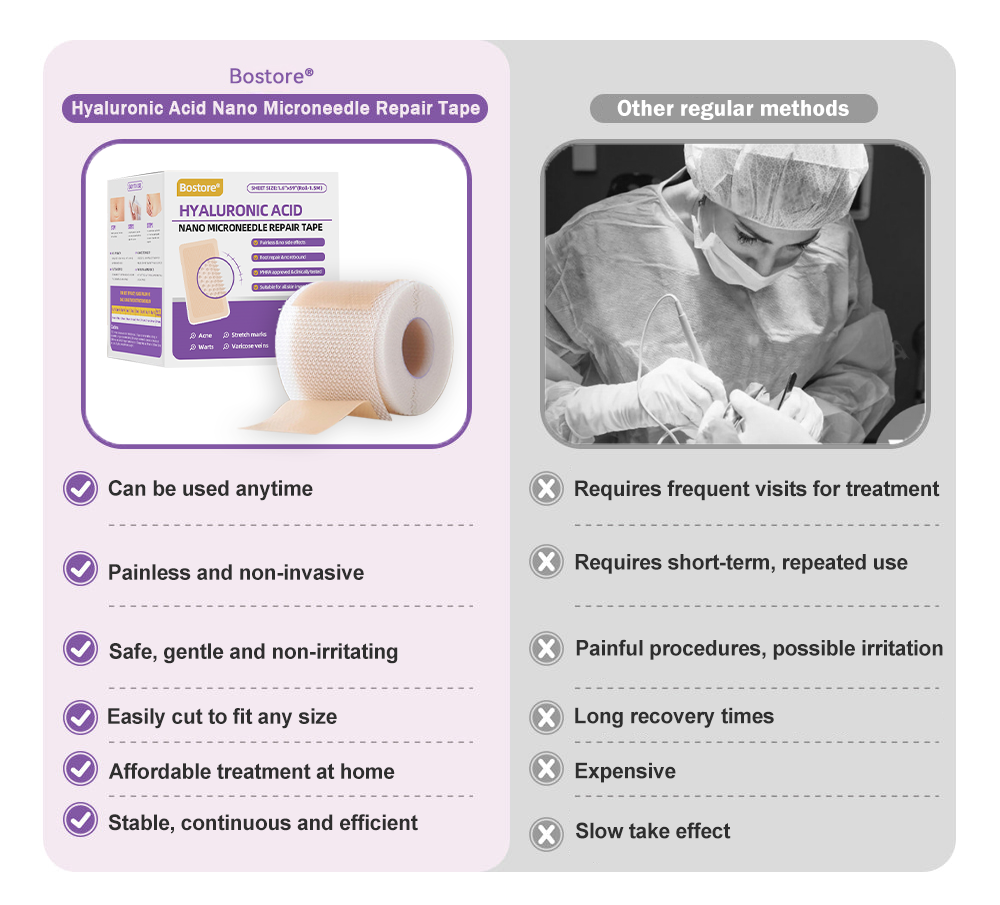 Totai Skin Confidence Începe Aici ✅ Bostore® Acid Hialuronic Nano Microneedle Repair Tape ✴️ Pentru diverse cicatrici, vergeturi, pete, keloide, keratoze, acnee, arsuri, negi, etichete de piele și vene varicoase.