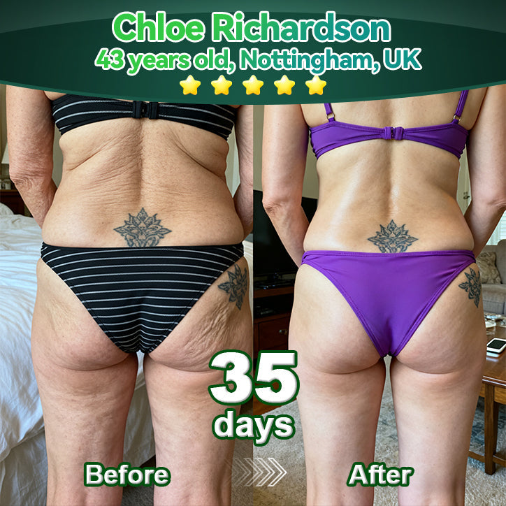 ⏳ Utolsó esély! Adj hozzá még 𝐋𝗼𝐭𝐦𝒂𝐲® termékeket, és élvezd a további 30% KEDVEZMÉNYT! Ez a kizárólagos 30% kedvezmény csak számodra van fenntartva!