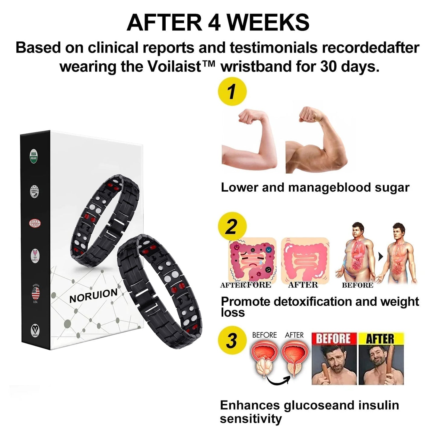 😍😍NORUION® Far Infrared Ionizer Bracelet🎁 Limited time 80% discount.