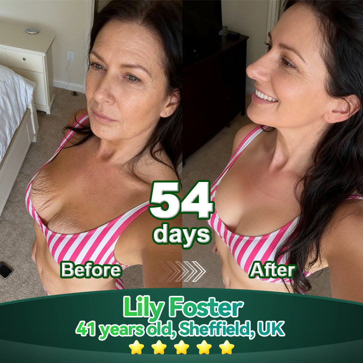 ⏳ Utolsó esély! Adj hozzá még 𝐋𝗼𝐭𝐦𝒂𝐲® termékeket, és élvezd a további 30% KEDVEZMÉNYT! Ez a kizárólagos 30% kedvezmény csak számodra van fenntartva!