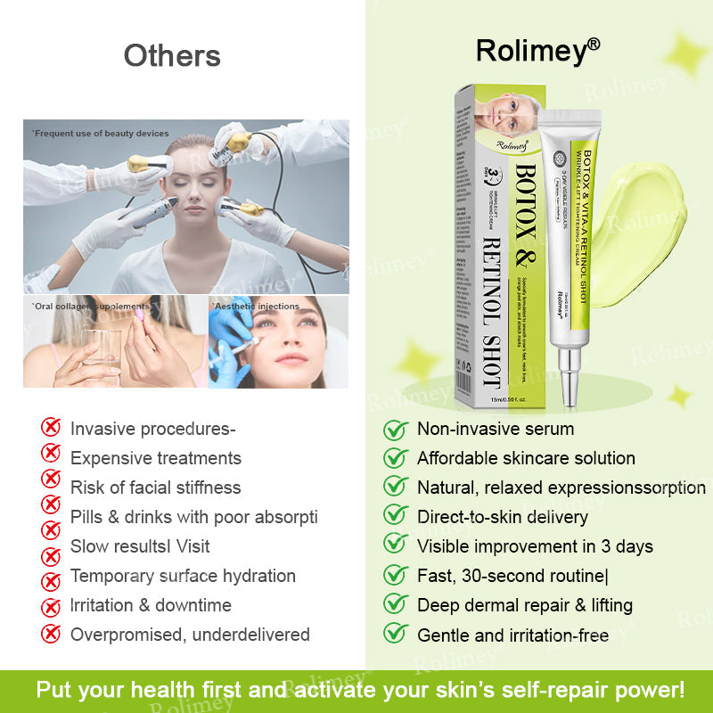 💛✅Az USA-ban gyártva és onnan szállítva 💫Rolimey® Botox & Vita-A Retinol Shot ránctalanító és feszesítő krém – Utolsó napos akció 70% kedvezmény
