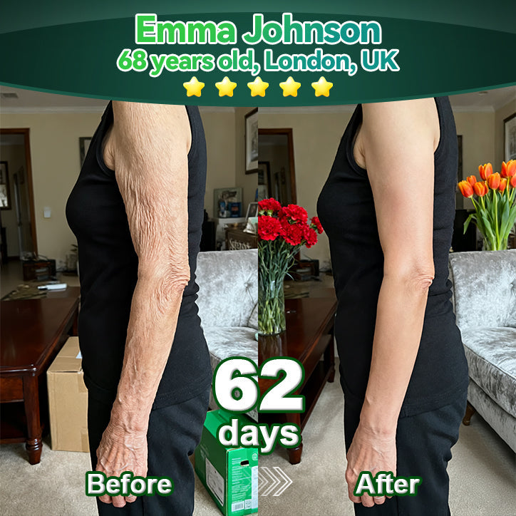 ⏳ Utolsó esély! Adj hozzá még 𝐋𝗼𝐭𝐦𝒂𝐲® termékeket, és élvezd a további 30% KEDVEZMÉNYT! Ez a kizárólagos 30% kedvezmény csak számodra van fenntartva!