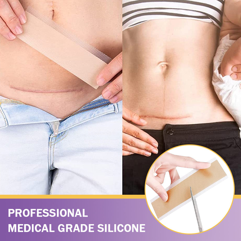 Totai Skin Confidence Începe Aici ✅ Bostore® Acid Hialuronic Nano Microneedle Repair Tape ✴️ Pentru diverse cicatrici, vergeturi, pete, keloide, keratoze, acnee, arsuri, negi, etichete de piele și vene varicoase.
