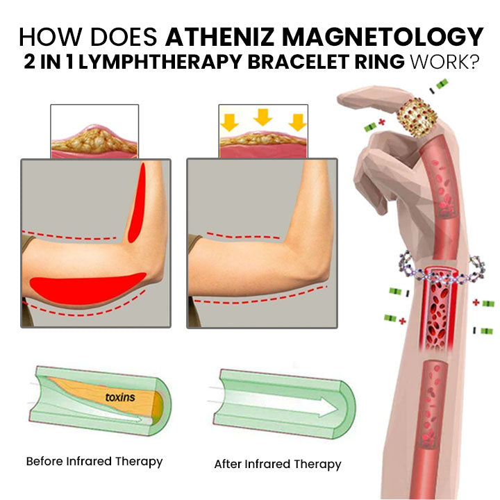 Atheniz Magnetology 2 IN 1 LymphTherapy Inel de brățară de limfoterapie