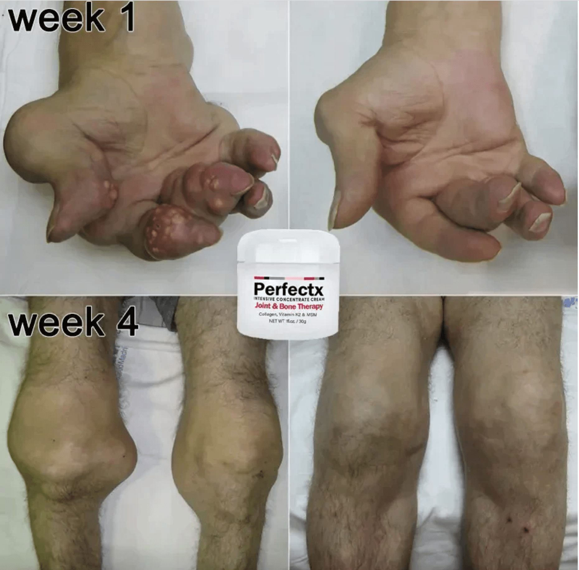 GFOUK™ Perfectx Joint & Bone Therapy Cream KJ 1668 